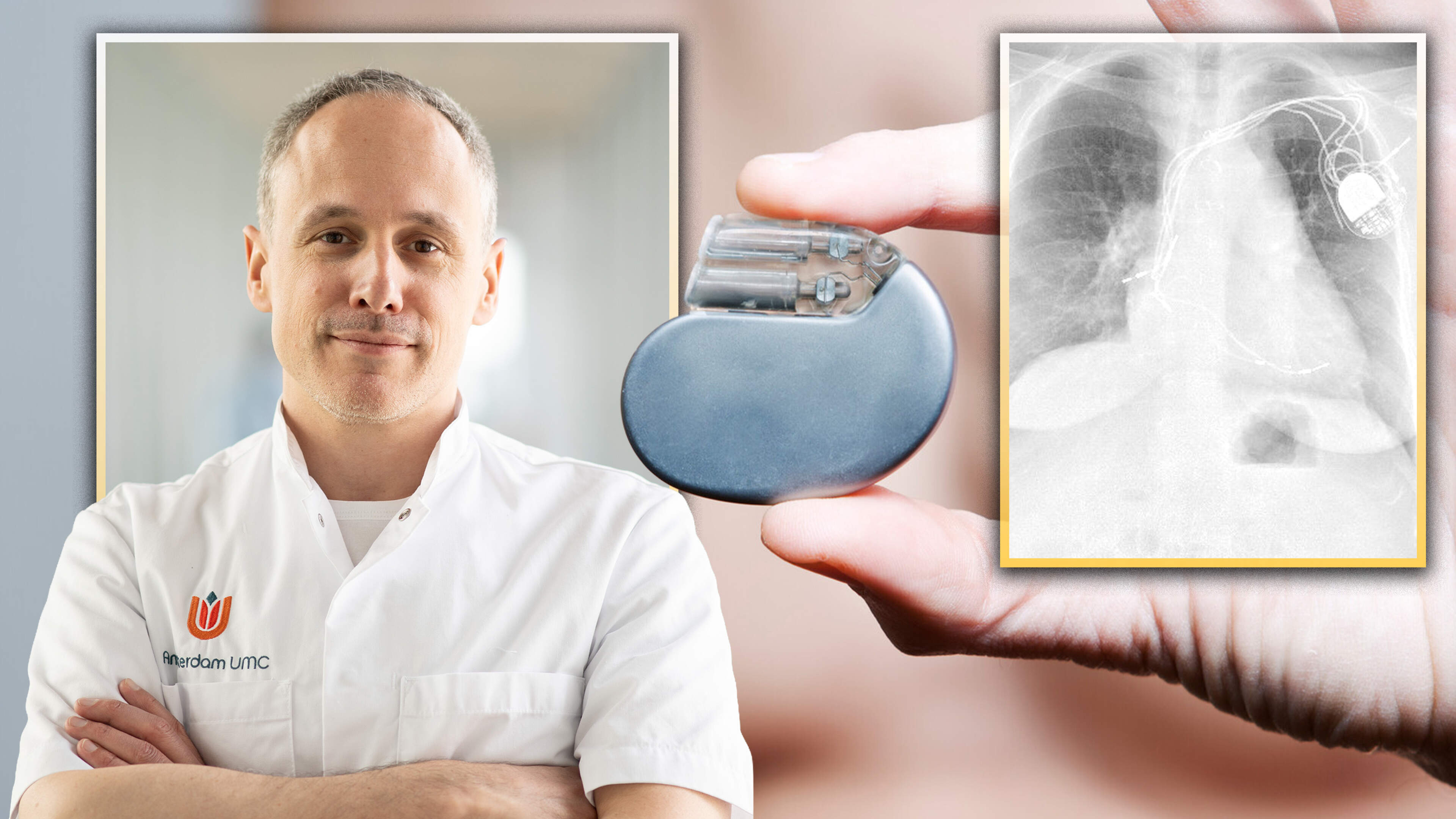 Nederlandse doorbraak in ontwikkeling van biologische pacemaker: ’Zo kunnen we die al tijdens zwangerschap inbrengen’